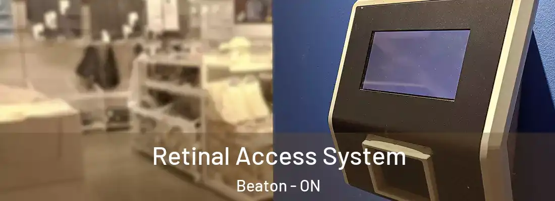  Retinal Access System Beaton - ON
