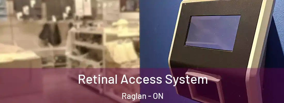 Retinal Access System Raglan - ON
